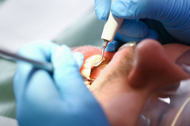 Best Orthodontic Emergency Dentist in Matheny, CA